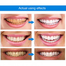 White Essence - Pluma para blanquear los dientes