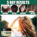 💇‍♀️VITAL ROOT💇CREMA DE JENGIBRE🫚PARA CRECER EL CABELLO X 30g📏 EELHOE🍃